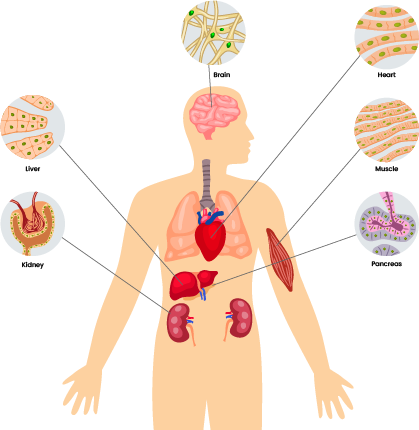 A diagram of a human body with organs often affected by mito highlighted. Heart, brain, muscles, kidney, liver and pancreas.