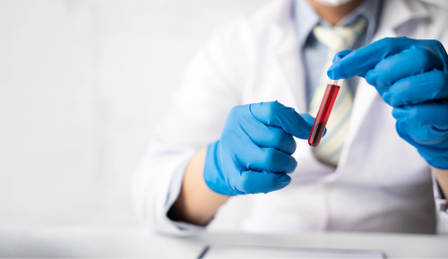 A healthcare professional holding a vial of blood in their hand.